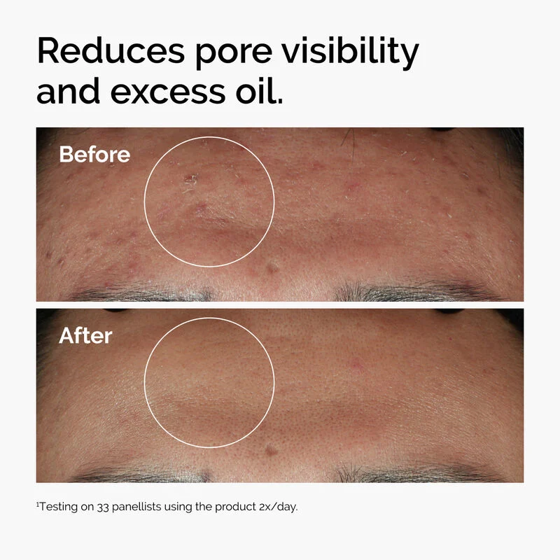 The Ordinary Niacinamide 10%+Zinc1% - Image 2