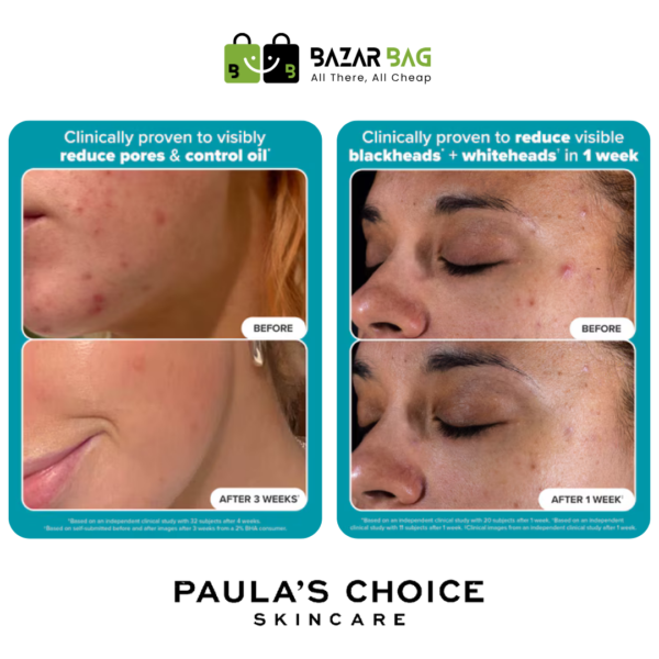 Paulas Choice Skin Perfecting 2% BHA Liquid Exfoliant 30ml - Image 2