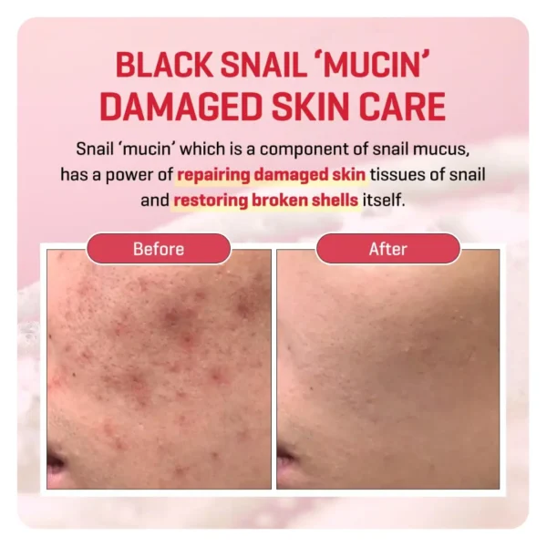 Some By Mi Snail Truecica Miracle Repair Serum – 50ml - Image 2