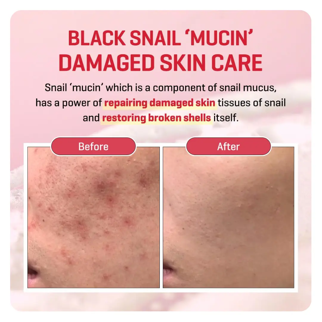 Some By Mi Snail Truecica Miracle Repair Serum – 50ml - Image 2
