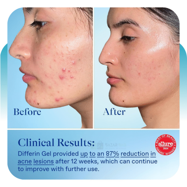 Differin Adapalene Gel 0.1% Acne Treatment 15g - Image 2