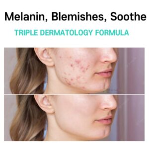 Care:Nel Anti-Melasma Cica Cream 40ml - Image 2