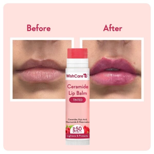 WishCare Ceramide Tinted Lip Balm with SPF 50 PA+++ 5g - Image 3